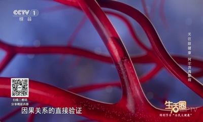 经典TV电视版下载